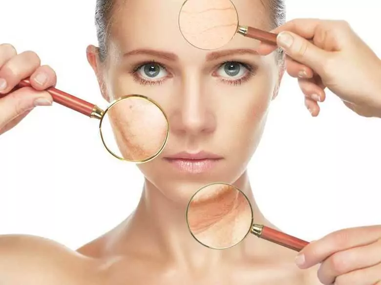 Z jakich przyczyn na skórze pojawiać się mogą popękane naczynka (tzw. pajączki)?