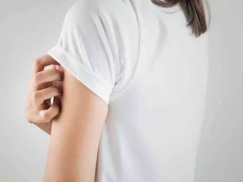 Czym jest alergia kontaktowa?